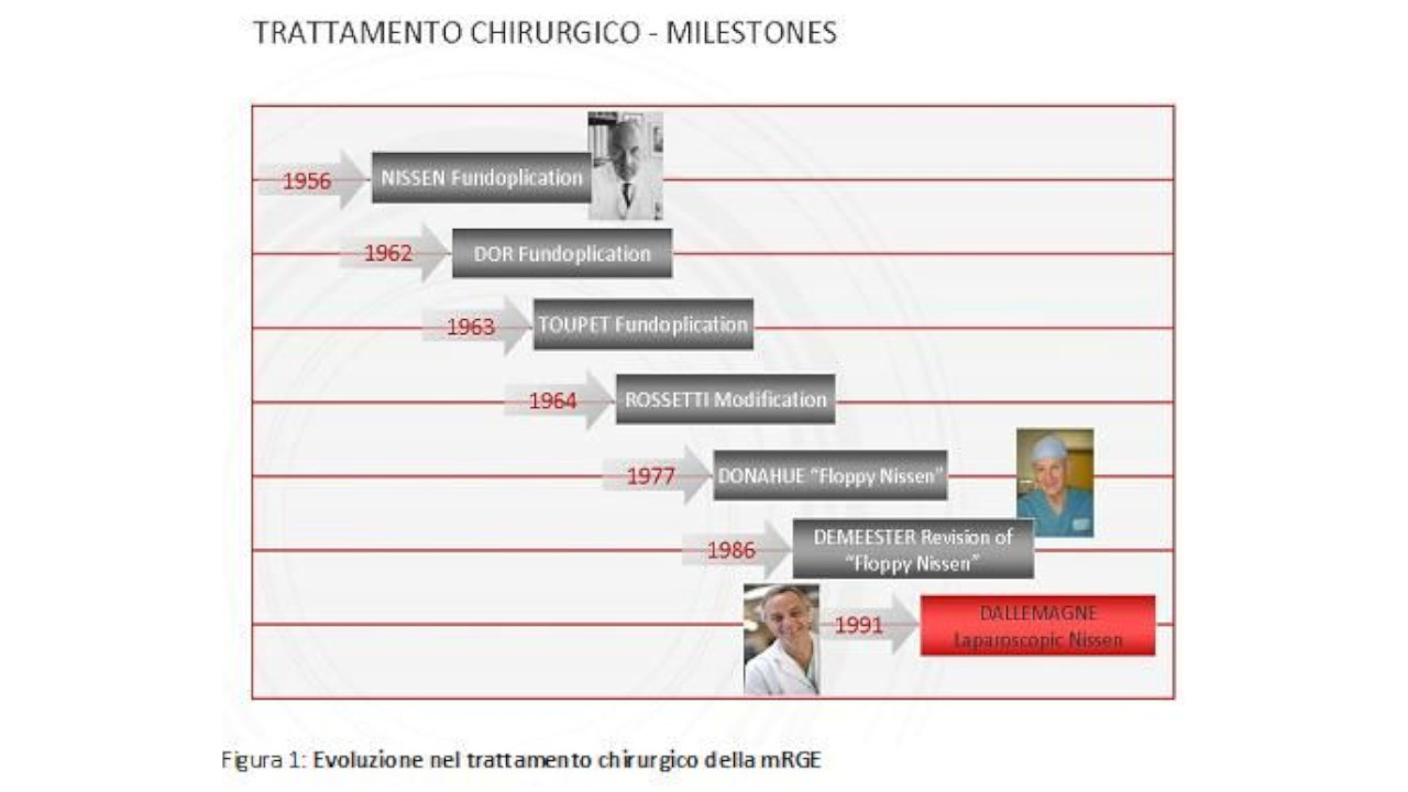 La Malattia da reflusso gastro-esofageo