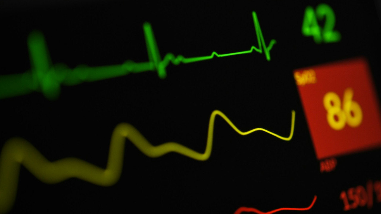 Fibrillazione atriale anche con gli anticoagulanti il rischio di declino cognitivo resta elevato Fibrillazione atriale anche con gli anticoagulanti il rischio di declino cognitivo resta elevato